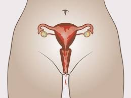contraction uterine et regles douloureuse